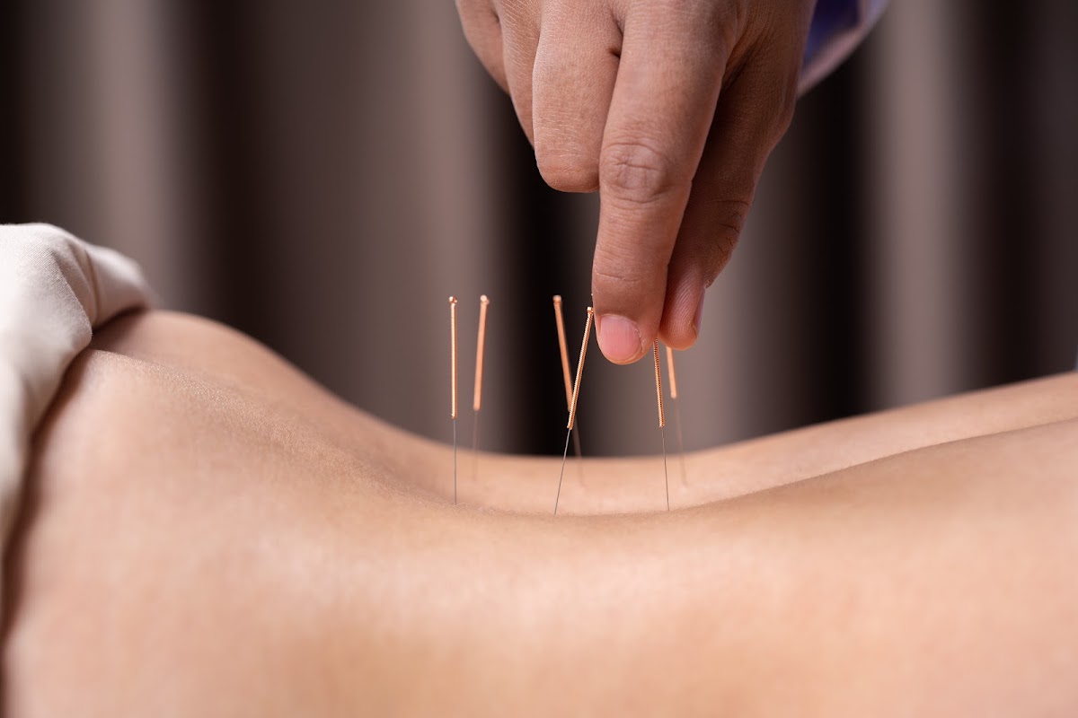 Apex Physiotherapy & Chiropractic - Kingston Road