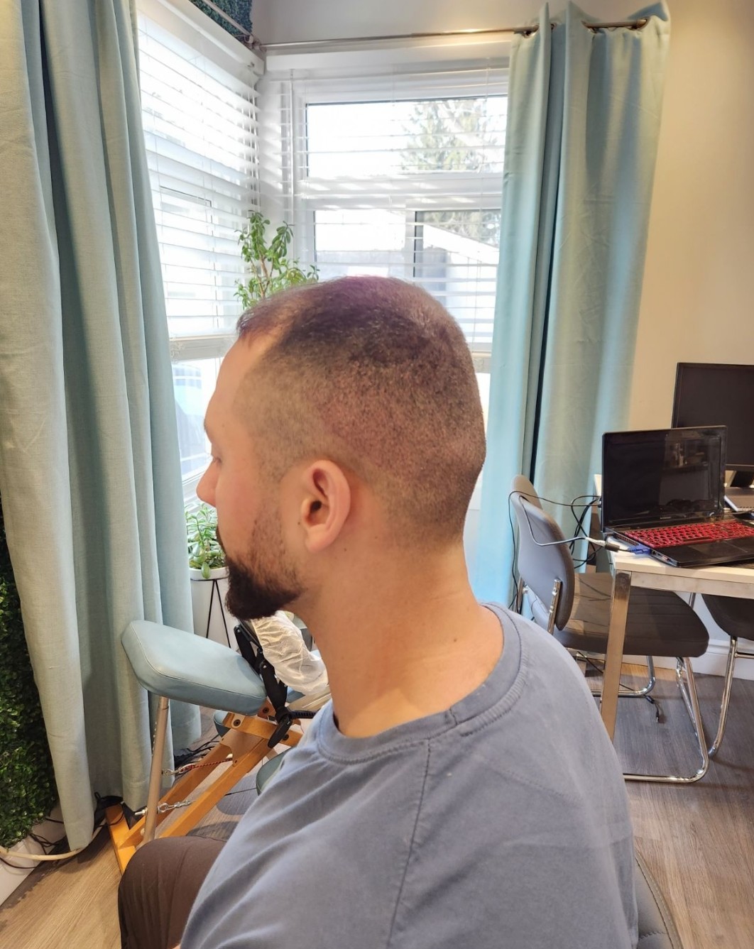 Dr Hair Tattoo c/o SMP Scalp Micropigmentation