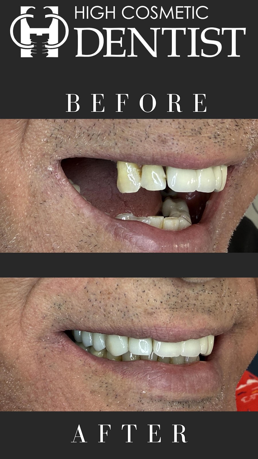 High Cosmetic Dentist