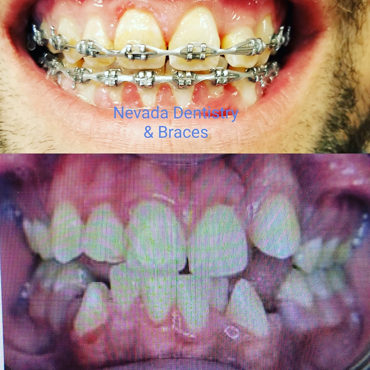 Nevada Dentistry & Braces