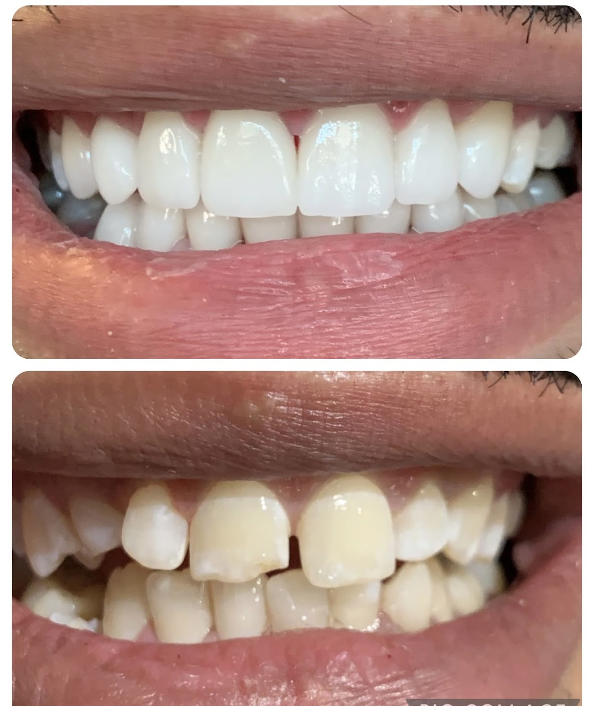 Dr. Patty Miami Cosmetic Dentistry