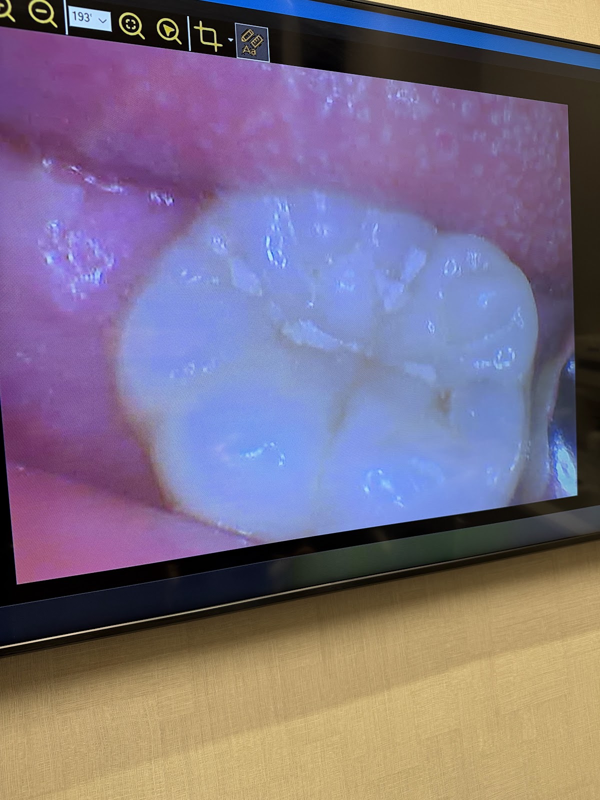 New West Dentistry & Implant Centre