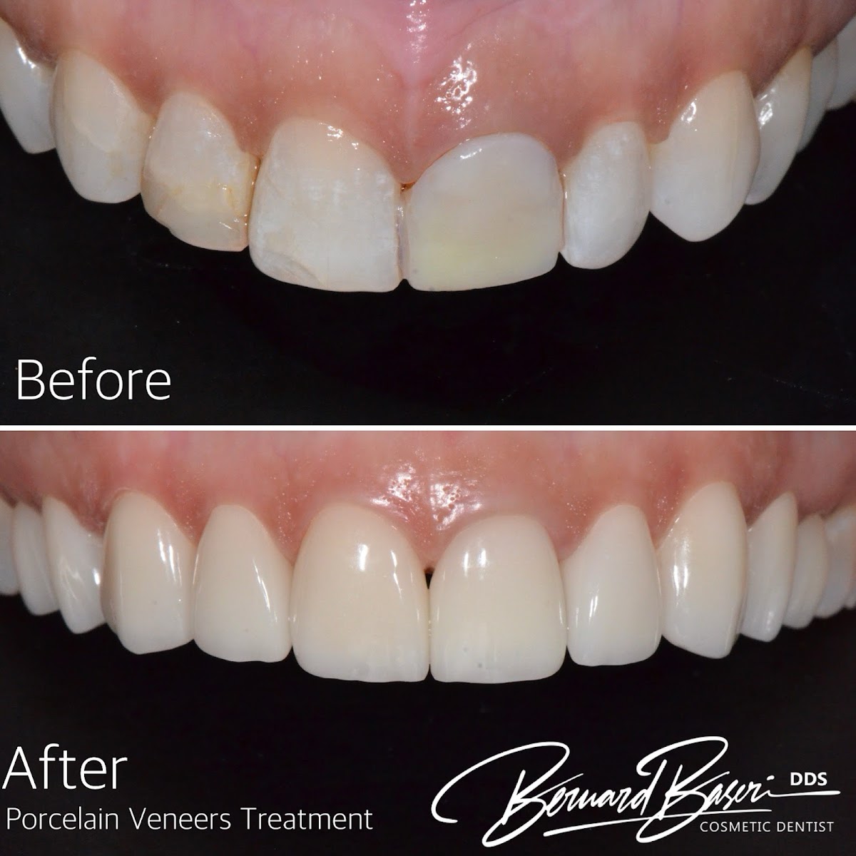 Smile Recreation Dentistry by Dr. Baseri