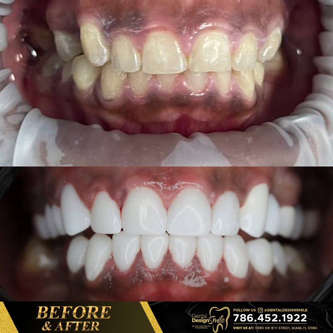 Dental Design Smile