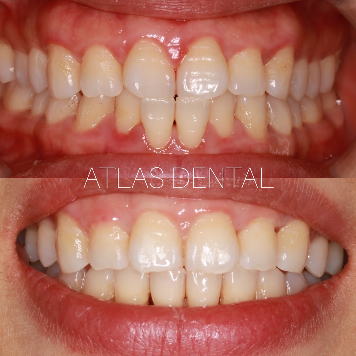 Atlas Dental
