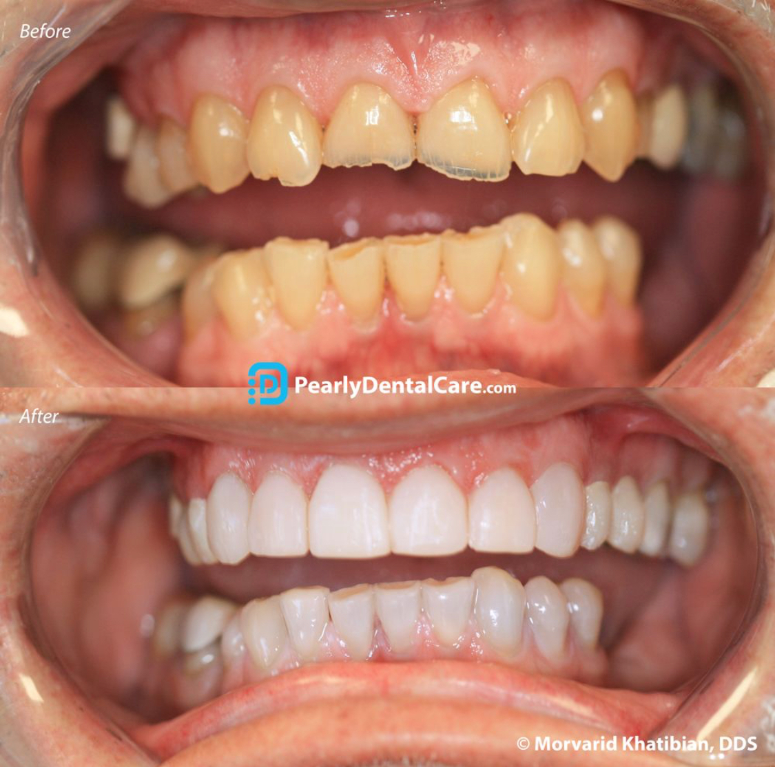Pearly Dental Care San Jose