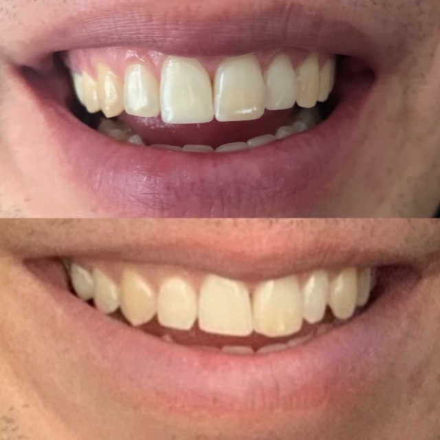 Ambiance Dental Calgary